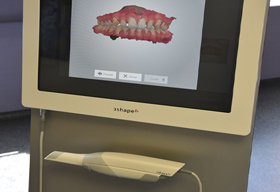Scanner 3D